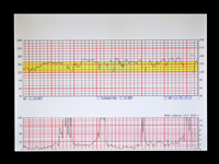 fetal-monitoring-strip-scanning